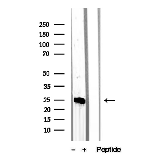 MPZL2 Antibody - Western blot analysis of extracts of Jurkat cells using MPZL2 antibody.