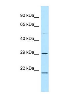 MPZL3 Antibody - MPZL3 antibody Western blot of Fetal Brain lysate. Antibody concentration 1 ug/ml.  This image was taken for the unconjugated form of this product. Other forms have not been tested.