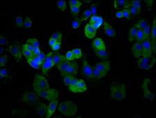 MPZL3 Antibody - Immunofluorescence staining of MCF-7 cells diluted at 1:66, counter-stained with DAPI. The cells were fixed in 4% formaldehyde, permeabilized using 0.2% Triton X-100 and blocked in 10% normal Goat Serum. The cells were then incubated with the antibody overnight at 4°C.The Secondary antibody was Alexa Fluor 488-congugated AffiniPure Goat Anti-Rabbit IgG (H+L).