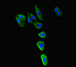 MR1 Antibody - Immunofluorescent analysis of HepG-2 cells diluted at 1:100 and Alexa Fluor 488-congugated AffiniPure Goat Anti-Rabbit IgG(H+L)