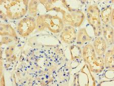 MR1 Antibody - Immunohistochemistry of paraffin-embedded human kidney tissue at dilution 1:100