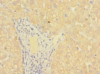 MR1 Antibody - Paraffin-embedding Immunohistochemistry using human liver tissue at dilution 1:100