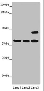 MR1 Antibody - Western blot All Lanes: MR1 antibody at 6 ug/ml Lane 1: Thp-1 whole cell lysate Lane 2: K562 whole cell lysate Lane 3: Mouse brain tissue Secondary Goat polyclonal to rabbit IgG at 1/10000 dilution Predicted band size: 40,35,29,26 kDa Observed band size: 39,45 kDa