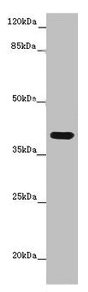 MR1 Antibody - Western blot All lanes: MR1 antibody at 6µg/ml + K562 whole cell lysate Secondary Goat polyclonal to rabbit IgG at 1/10000 dilution Predicted band size: 40, 35, 29, 26 kDa Observed band size: 40 kDa
