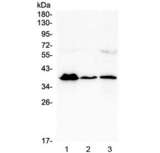 MR1 Antibody - Western blot testing of human 1) T-47D, 2) U937 and 3) A431 cell lysate with MR1 antibody at 0.5ug/ml. Predicted molecular weight ~39 kDa.