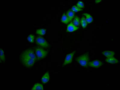 MRAP Antibody - Immunofluorescence staining of Hela cells diluted at 1:133, counter-stained with DAPI. The cells were fixed in 4% formaldehyde, permeabilized using 0.2% Triton X-100 and blocked in 10% normal Goat Serum. The cells were then incubated with the antibody overnight at 4°C.The Secondary antibody was Alexa Fluor 488-congugated AffiniPure Goat Anti-Rabbit IgG (H+L).