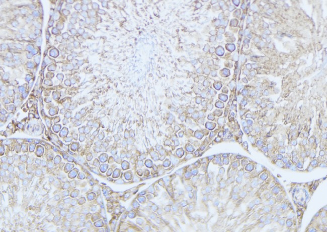 MRAP Antibody - 1:100 staining mouse testis tissue by IHC-P. The sample was formaldehyde fixed and a heat mediated antigen retrieval step in citrate buffer was performed. The sample was then blocked and incubated with the antibody for 1.5 hours at 22°C. An HRP conjugated goat anti-rabbit antibody was used as the secondary.