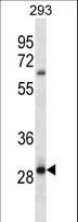 MRAP2 Antibody - MRAP2 Antibody western blot of 293 cell line lysates (35 ug/lane). The MRAP2 antibody detected the MRAP2 protein (arrow).