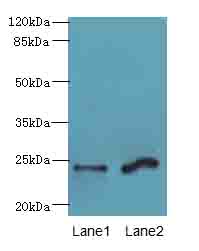 MRAP2 Antibody - Western blot. All lanes: MRAP2 antibody at 7 ug/ml. Lane 1: Mouse brain tissue. Lane 2: Mouse kidney tissue. Secondary Goat polyclonal to Rabbit IgG at 1:10000 dilution. Predicted band size: 24 kDa. Observed band size: 24 kDa.
