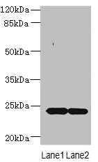 MRAP2 Antibody - Western blot All lanes: MRAP2 antibody at 7µg/ml Lane 1: Mouse brain tissue Lane 2: Mouse kidney tissue Secondary Goat polyclonal to rabbit IgG at 1/10000 dilution Predicted band size: 24 kDa Observed band size: 24 kDa