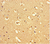 MRAP2 Antibody - Immunohistochemistry of paraffin-embedded human brain tissue using MRAP2 Antibody at dilution of 1:100