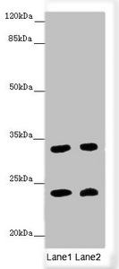 MRAS Antibody - Western blot All Lanes: MRAS antibody at 3.44 ug/ml Lane 1: Mouse brain tissue Lane 2: Mouse heart tissue Secondary Goat polyclonal to rabbit IgG at 1/10000 dilution Predicted band size: 24,16 kDa Observed band size: 24,32 kDa