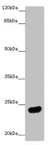 MRAS Antibody - Western blot All Lanes:MRAS antibody at 2.61 ug/ml + Mouse brain tissue Secondary Goat polyclonal to rabbit IgG at 1/10000 dilution Predicted band size: 24,16 kDa Observed band size: 24 kDa