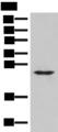MRAS Antibody - Western blot analysis of Human fetal brain tissue lysate  using MRAS Polyclonal Antibody at dilution of 1:400