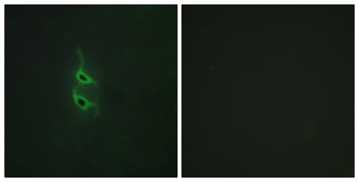 MRC2 / Endo180 Antibody - Immunofluorescence analysis of HepG2 cells, using MRC2 Antibody. The picture on the right is blocked with the synthesized peptide.