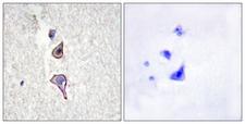 MRC2 / Endo180 Antibody - Immunohistochemistry analysis of paraffin-embedded human brain tissue, using MRC2 Antibody. The picture on the right is blocked with the synthesized peptide.