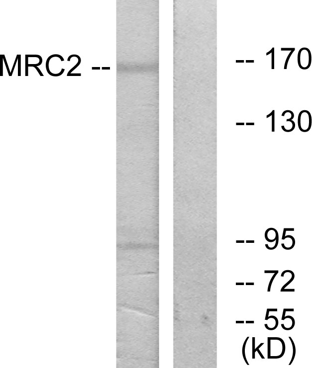 MRC2 / Endo180 Antibody - Western blot analysis of lysates from 293 cells, using MRC2 Antibody. The lane on the right is blocked with the synthesized peptide.