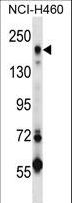 MRC2 / Endo180 Antibody - MRC2 Antibody western blot of NCI-H460 cell line lysates (35 ug/lane). The MRC2 antibody detected the MRC2 protein (arrow).