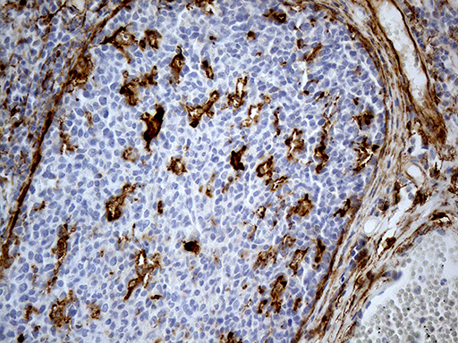 MRC2 / Endo180 Antibody - Immunohistochemical staining of paraffin-embedded Human tonsil within the normal limits using anti-MRC2 mouse monoclonal antibody. (Heat-induced epitope retrieval by 1mM EDTA in 10mM Tris buffer. (pH8.5) at 120°C for 3 min. (1:5000)