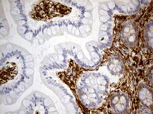 MRC2 / Endo180 Antibody - Immunohistochemical staining of paraffin-embedded Human colon tissue within the normal limits using anti-MRC2 mouse monoclonal antibody. (Heat-induced epitope retrieval by 1mM EDTA in 10mM Tris buffer. (pH8.5) at 120°C for 3 min. (1:5000)