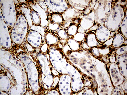 MRC2 / Endo180 Antibody - Immunohistochemical staining of paraffin-embedded Human Kidney tissue within the normal limits using anti-MRC2 mouse monoclonal antibody. (Heat-induced epitope retrieval by 1mM EDTA in 10mM Tris buffer. (pH8.5) at 120°C for 3 min. (1:5000)