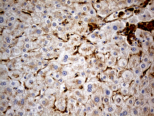 MRC2 / Endo180 Antibody - Immunohistochemical staining of paraffin-embedded Human liver tissue within the normal limits using anti-MRC2 mouse monoclonal antibody. (Heat-induced epitope retrieval by 1mM EDTA in 10mM Tris buffer. (pH8.5) at 120°C for 3 min. (1:5000)