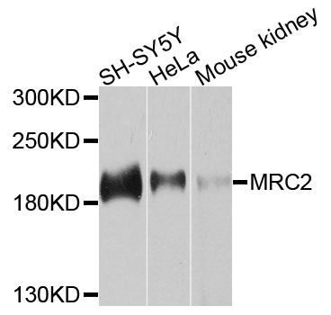 MRC2 / Endo180 Antibody - Western blot analysis of extracts of various cells.