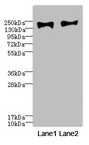 MRC2 / Endo180 Antibody - Western blot All Lanes: MRC2 antibody at 3.84ug/ml Lane 1: HepG-2 whole cell lysate Lane 2: A549 whole cell lysate Secondary Goat polyclonal to rabbit IgG at 1/10000 dilution Predicted band size: 167 kDa Observed band size: 167 kDa