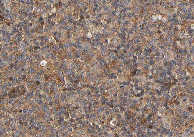 MRC2 / Endo180 Antibody - 1:100 staining human lymph node tissue by IHC-P. The tissue was formaldehyde fixed and a heat mediated antigen retrieval step in citrate buffer was performed. The tissue was then blocked and incubated with the antibody for 1.5 hours at 22°C. An HRP conjugated goat anti-rabbit antibody was used as the secondary.