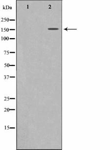 MRC2 / Endo180 Antibody - Western blot analysis on 293 cell lysates using MRC2 antibody. The lane on the left is treated with the antigen-specific peptide.