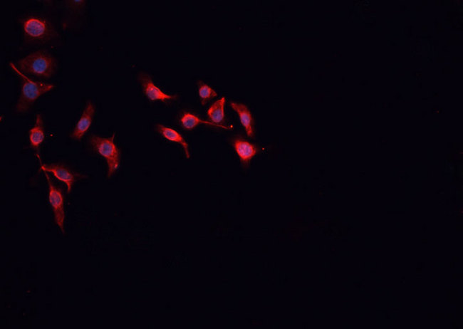 MRC2 / Endo180 Antibody - Staining HepG2 cells by IF/ICC. The samples were fixed with PFA and permeabilized in 0.1% Triton X-100, then blocked in 10% serum for 45 min at 25°C. The primary antibody was diluted at 1:200 and incubated with the sample for 1 hour at 37°C. An Alexa Fluor 594 conjugated goat anti-rabbit IgG (H+L) antibody, diluted at 1/600, was used as secondary antibody.