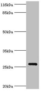 MRDS1 / OFCC1 Antibody - Western blot All lanes: Orofacial cleft 1 candidate gene 1 antibody at 2µg/ml + Mouse gonad tissue Secondary Goat polyclonal to rabbit IgG at 1/10000 dilution Predicted band size: 27, 32, 21, 14, 16 kDa Observed band size: 27 kDa