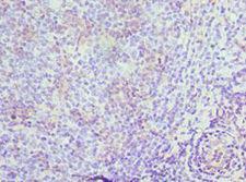 MRE11A / MRE11 Antibody - Immunohistochemistry of paraffin-embedded human tonsil using antibody at 1:100 dilution.
