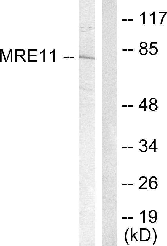 MRE11A / MRE11 Antibody - Western blot analysis of lysates from Jurkat cells, treated with UV 15', using MRE11 Antibody. The lane on the right is blocked with the synthesized peptide.