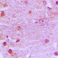 MRE11A / MRE11 Antibody - Immunohistochemical analysis of MRE11 staining in human brain formalin fixed paraffin embedded tissue section. The section was pre-treated using heat mediated antigen retrieval with sodium citrate buffer (pH 6.0). The section was then incubated with the antibody at room temperature and detected using an HRP conjugated compact polymer system. DAB was used as the chromogen. The section was then counterstained with hematoxylin and mounted with DPX.