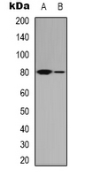 MRE11A / MRE11 Antibody - Western blot analysis of MRE11 expression in K562 (A); Jurkat (B) whole cell lysates.