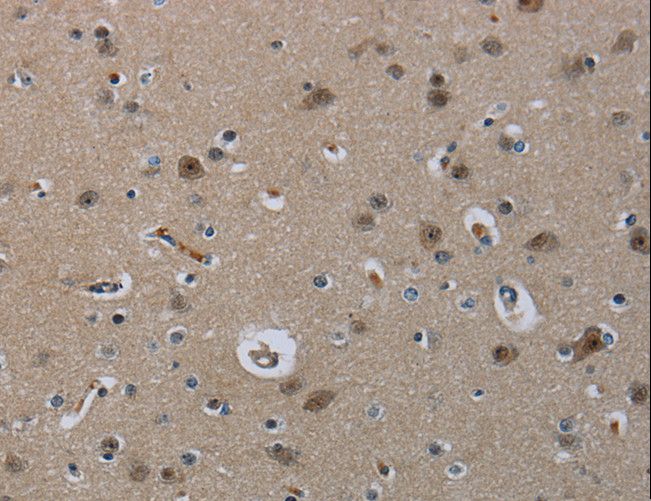 MRE11A / MRE11 Antibody - Immunohistochemistry of paraffin-embedded Human brain using MRE11A Polyclonal Antibody at dilution of 1:60.