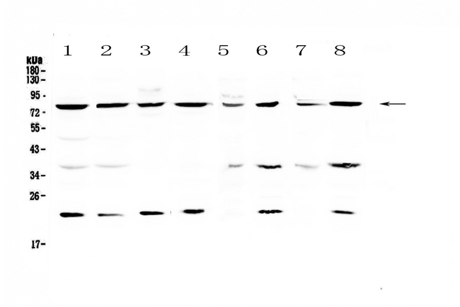 MRE11A / MRE11 Antibody - Western blot analysis of MRE11 using anti-MRE11 antibody. Electrophoresis was performed on a 5-20% SDS-PAGE gel at 70V (Stacking gel) / 90V (Resolving gel) for 2-3 hours. The sample well of each lane was loaded with 50ug of sample under reducing conditions. Lane 1: human Hela whole cell lysates,Lane 2: human MCF-7 whole cell lysates,Lane 3: human COLO-320 whole cell lysates,Lane 4: human U-87MG whole cell lysates,Lane 5: rat brain tissue lysates,Lane 6: rat liver tissue lysates,Lane 7: mouse brain tissue lysates,Lane 8: mouse liver tissue lysates. After Electrophoresis, proteins were transferred to a Nitrocellulose membrane at 150mA for 50-90 minutes. Blocked the membrane with 5% Non-fat Milk/ TBS for 1.5 hour at RT. The membrane was incubated with rabbit anti-MRE11 antigen affinity purified polyclonal antibody at 0.5 µg/mL overnight at 4°C, then washed with TBS-0.1% Tween 3 times with 5 minutes each and probed with a goat anti-rabbit IgG-HRP secondary antibody at a dilution of 1:10000 for 1.5 hour at RT. The signal is developed using an Enhanced Chemiluminescent detection (ECL) kit with Tanon 5200 system. A specific band was detected for MRE11 at approximately 81KD. The expected band size for MRE11 is at 81KD.