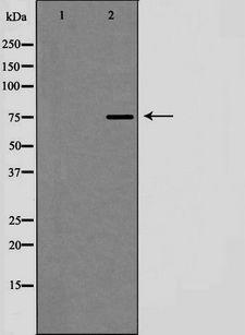 MRE11A / MRE11 Antibody - Western blot analysis of MRE11A expression in LOVO cells. The lane on the left is treated with the antigen-specific peptide.