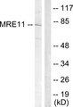 MRE11A / MRE11 Antibody - Western blot analysis of extracts from Jurkat cells, treated with UV (15mins), using MRE11 (Ab-264) antibody.