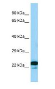 MREG Antibody - MREG antibody Western Blot of Jurkat.  This image was taken for the unconjugated form of this product. Other forms have not been tested.