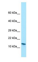MRFAP1 / PGR1 Antibody - MRFAP1 / PGR1 antibody Western Blot of Jurkat cell lysate.  This image was taken for the unconjugated form of this product. Other forms have not been tested.