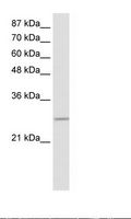 MRGBP Antibody - Transfected 293T Cell Lysate.  This image was taken for the unconjugated form of this product. Other forms have not been tested.
