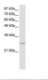 MRGBP Antibody - Transfected 293T Cell Lysate.  This image was taken for the unconjugated form of this product. Other forms have not been tested.