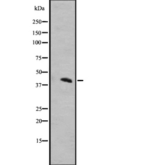 MRGD / MRGPRD Antibody - Western blot analysis of MRGRD expression in A431 whole cells lysate. The lane on the left is treated with the antigen-specific peptide.