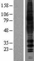 MRGD / MRGPRD Protein - Western validation with an anti-DDK antibody * L: Control HEK293 lysate R: Over-expression lysate
