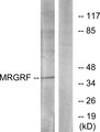 MRGPRF Antibody - Western blot analysis of lysates from HUVEC cells, using MRGRF Antibody. The lane on the right is blocked with the synthesized peptide.