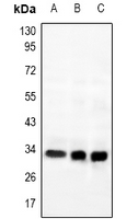 MRGPRG Antibody - Western blot analysis of GPR169 expression in PC12 (A), A549 (B), Hela (C) whole cell lysates.