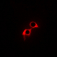 MRGPRG Antibody - Immunofluorescent analysis of GPR169 staining in A549 cells. Formalin-fixed cells were permeabilized with 0.1% Triton X-100 in TBS for 5-10 minutes and blocked with 3% BSA-PBS for 30 minutes at room temperature. Cells were probed with the primary antibody in 3% BSA-PBS and incubated overnight at 4 °C in a hidified chamber. Cells were washed with PBST and incubated with Alexa Fluor 647-conjugated secondary antibody (red) in PBS at room temperature in the dark.