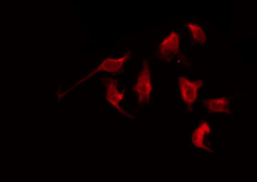 MRGPRG Antibody - Staining HuvEc cells by IF/ICC. The samples were fixed with PFA and permeabilized in 0.1% Triton X-100, then blocked in 10% serum for 45 min at 25°C. The primary antibody was diluted at 1:200 and incubated with the sample for 1 hour at 37°C. An Alexa Fluor 594 conjugated goat anti-rabbit IgG (H+L) Ab, diluted at 1/600, was used as the secondary antibody.